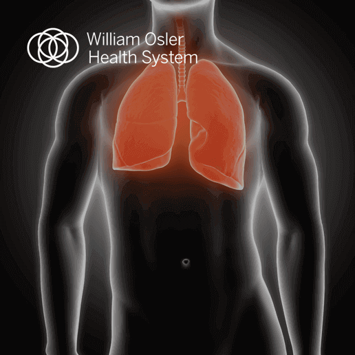 3D Lung Model