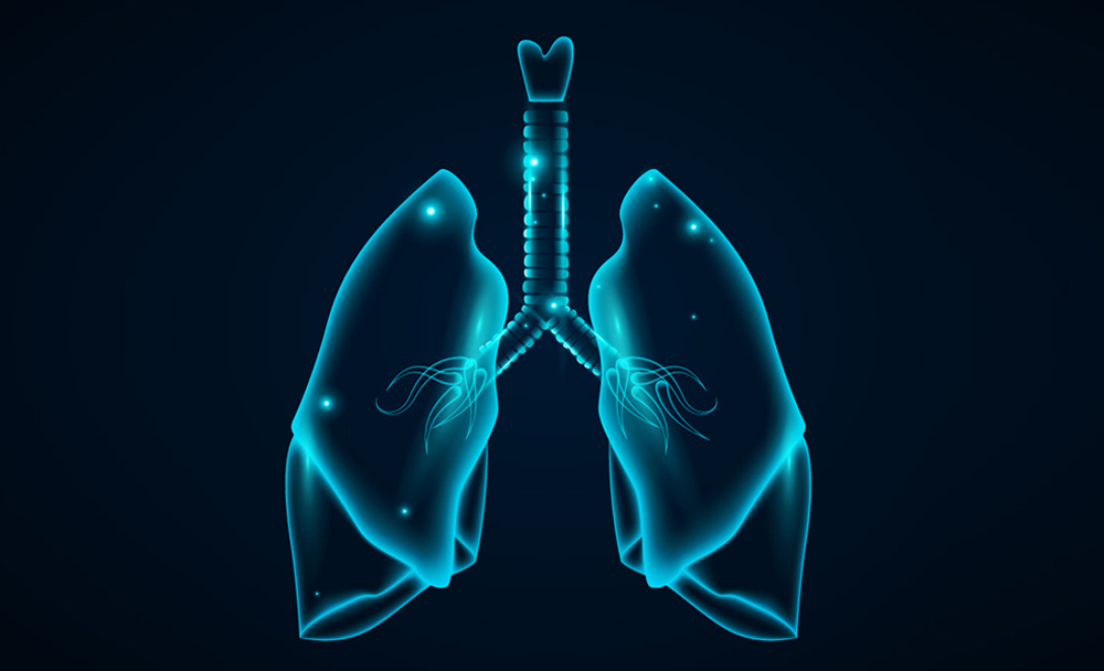A 3D lung model to help doctors educate patients.